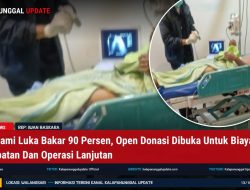 Andi Alami Luka Bakar 90 Persen, Open Donasi Dibuka Untuk Biaya Pengobatan Dan Operasi Lanjutan